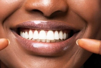 Cosmetic dentistry treatment at Garden Family Dental Centre