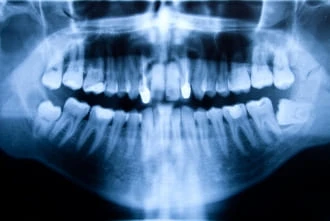 Digital X-ray imaging at Garden Family Dental Centre