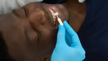 Doctor selecting veneers for a patient