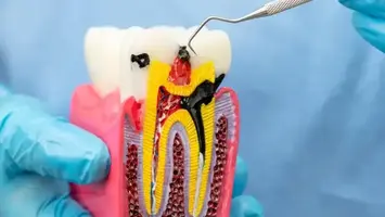 Dentist holding an artificial tooth implant
